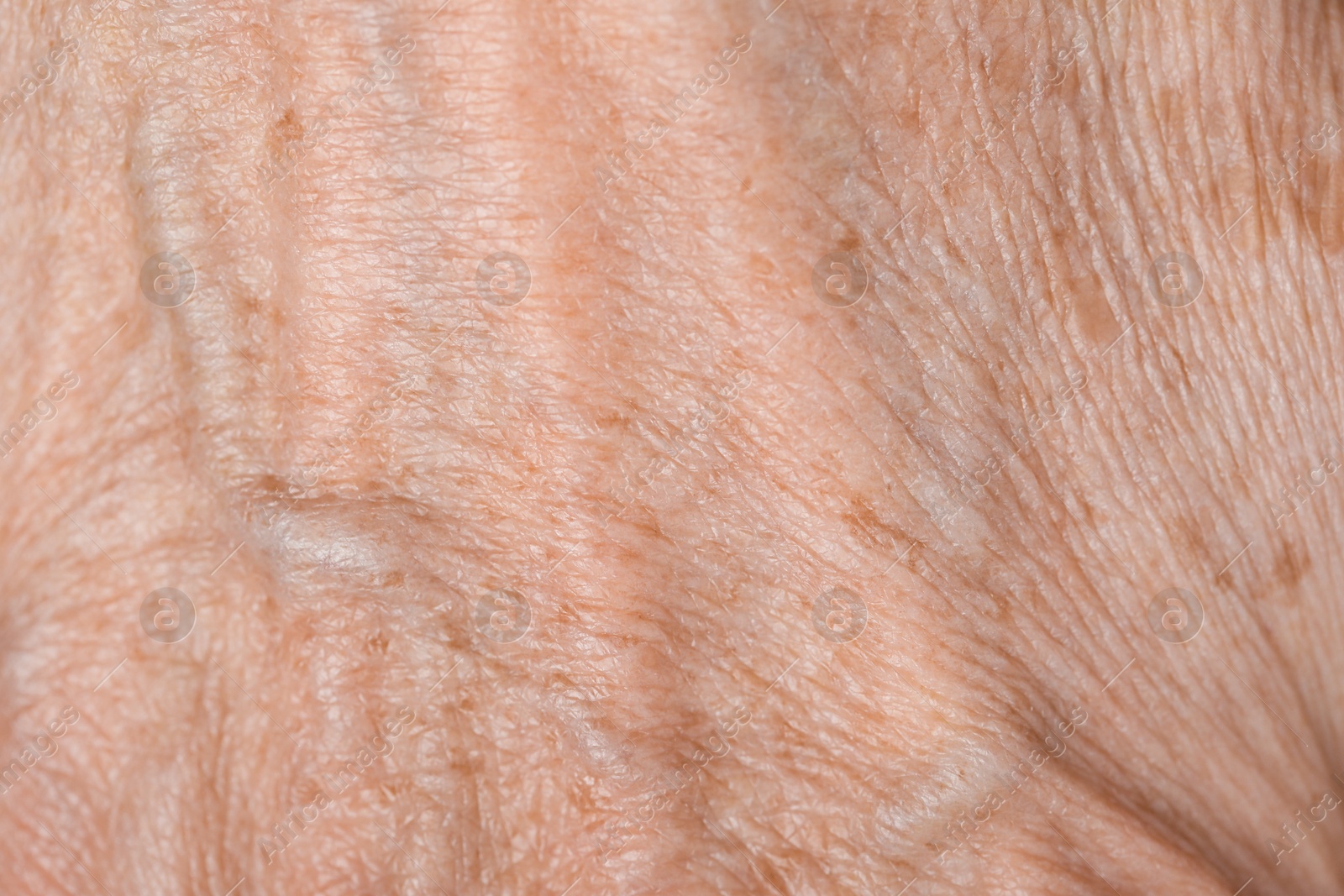 Photo of Macro view of skin with wrinkles as background