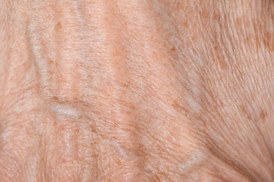 Macro view of skin with wrinkles as background