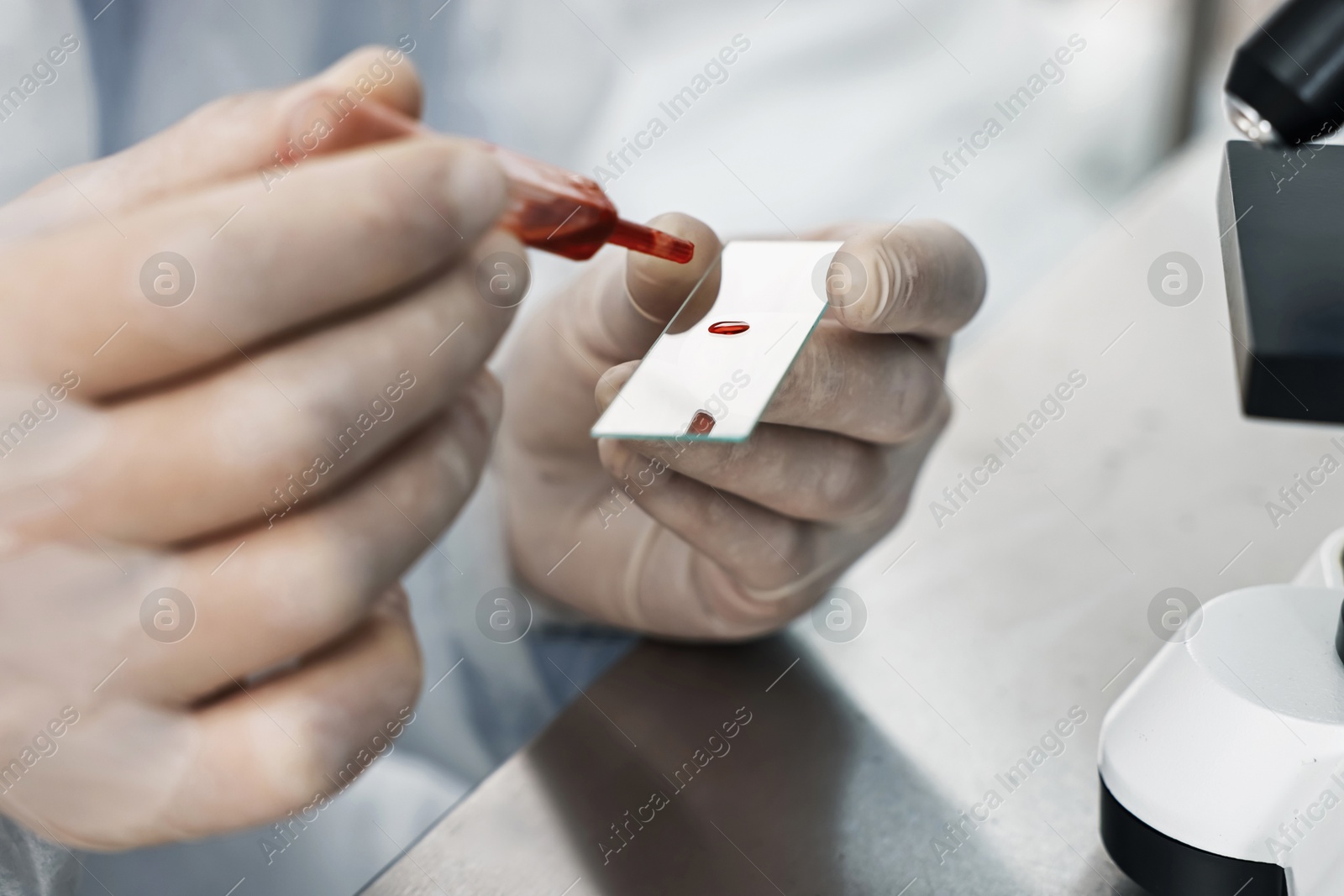 Photo of Scientist dripping blood sample onto glass slide in laboratory, closeup