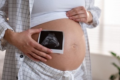 Photo of Pregnant woman with ultrasound scan at home, closeup