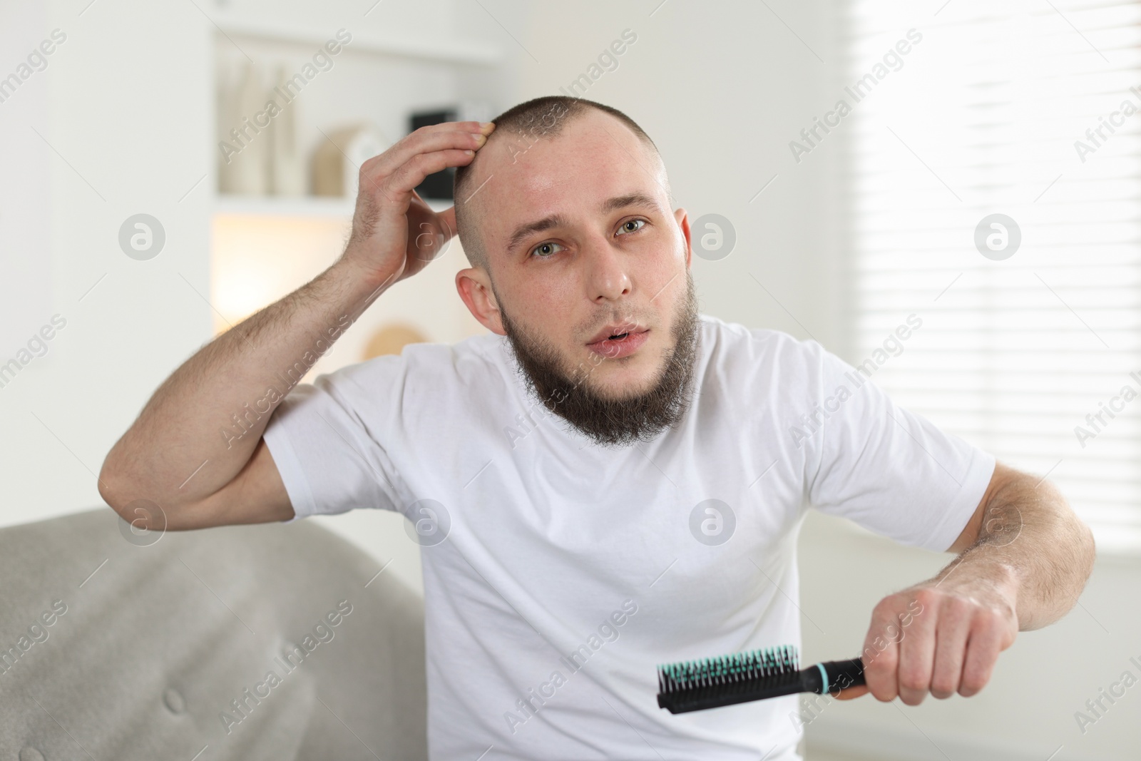 Baldness problem. Man with receding hairline holding brush at home Photo of Baldness problem. Man with receding hairline holding brush at home