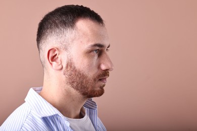 Photo of Baldness problem. Man with receding hairline on dark beige background, space for text