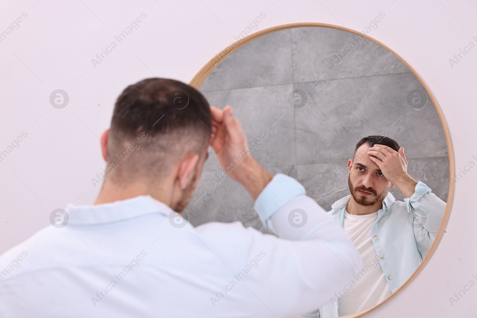 Photo of Baldness problem. Man with receding hairline near mirror in bathroom