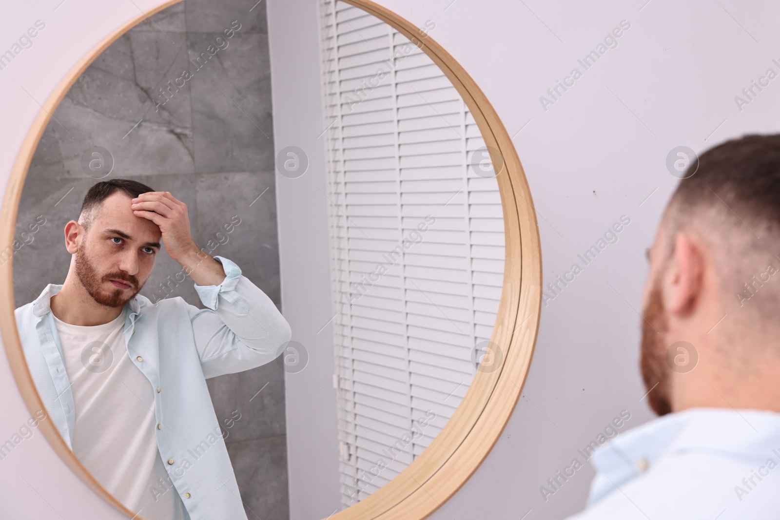 Photo of Baldness problem. Man with receding hairline near mirror in bathroom