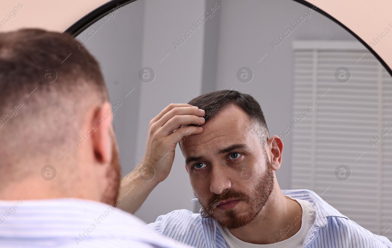 Photo of Baldness problem. Man with receding hairline near mirror in bathroom