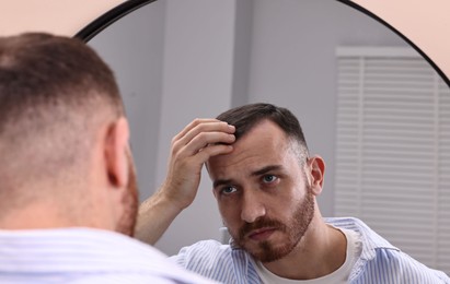 Photo of Baldness problem. Man with receding hairline near mirror in bathroom