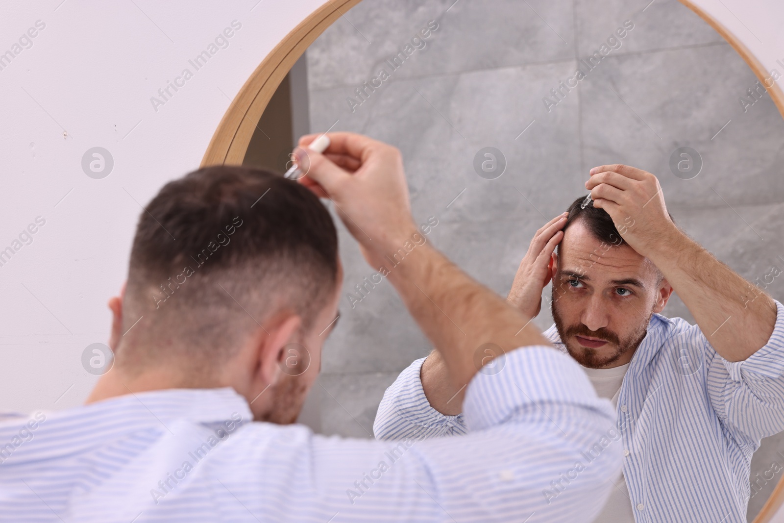 Photo of Baldness problem. Man applying serum onto hairline near mirror in bathroom