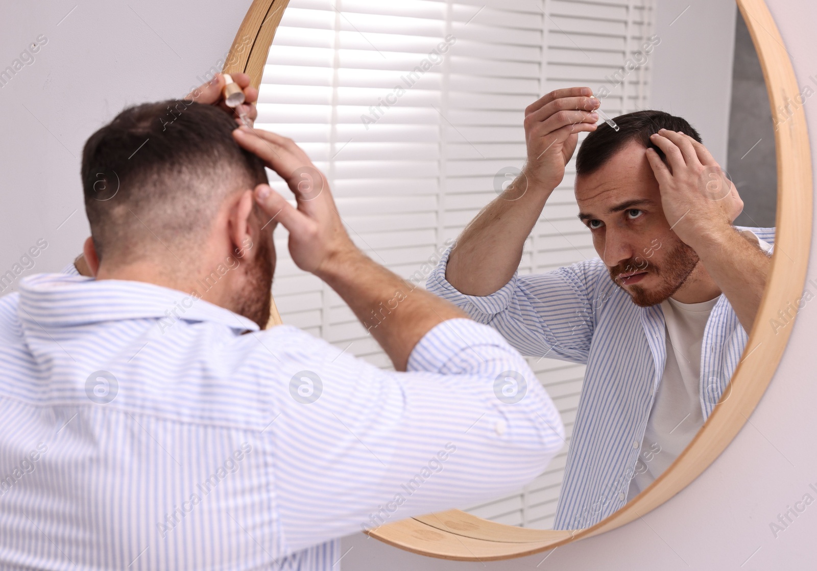 Photo of Baldness problem. Man applying serum onto hairline near mirror in bathroom