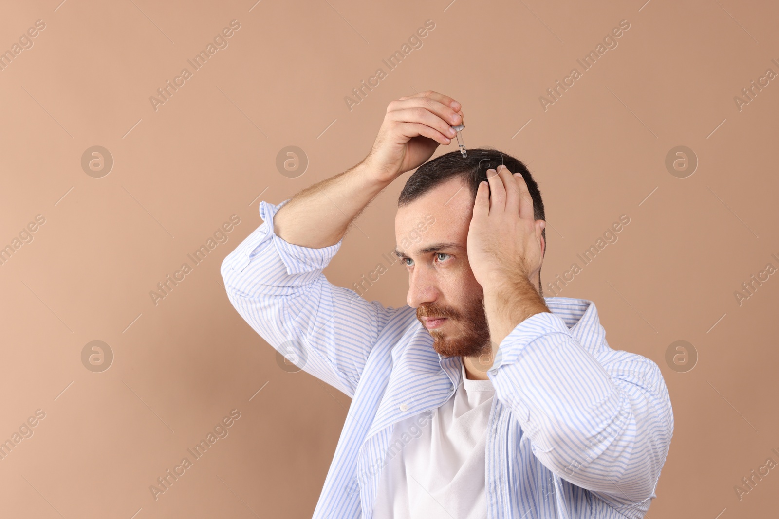 Photo of Baldness treatment. Man applying serum onto hair on beige background