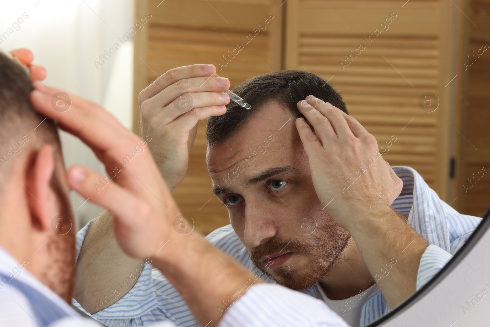 Photo of Baldness treatment. Man applying serum onto hair near mirror at home