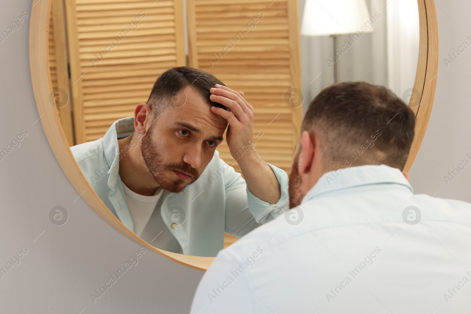 Photo of Baldness problem. Man with receding hairline near mirror at home