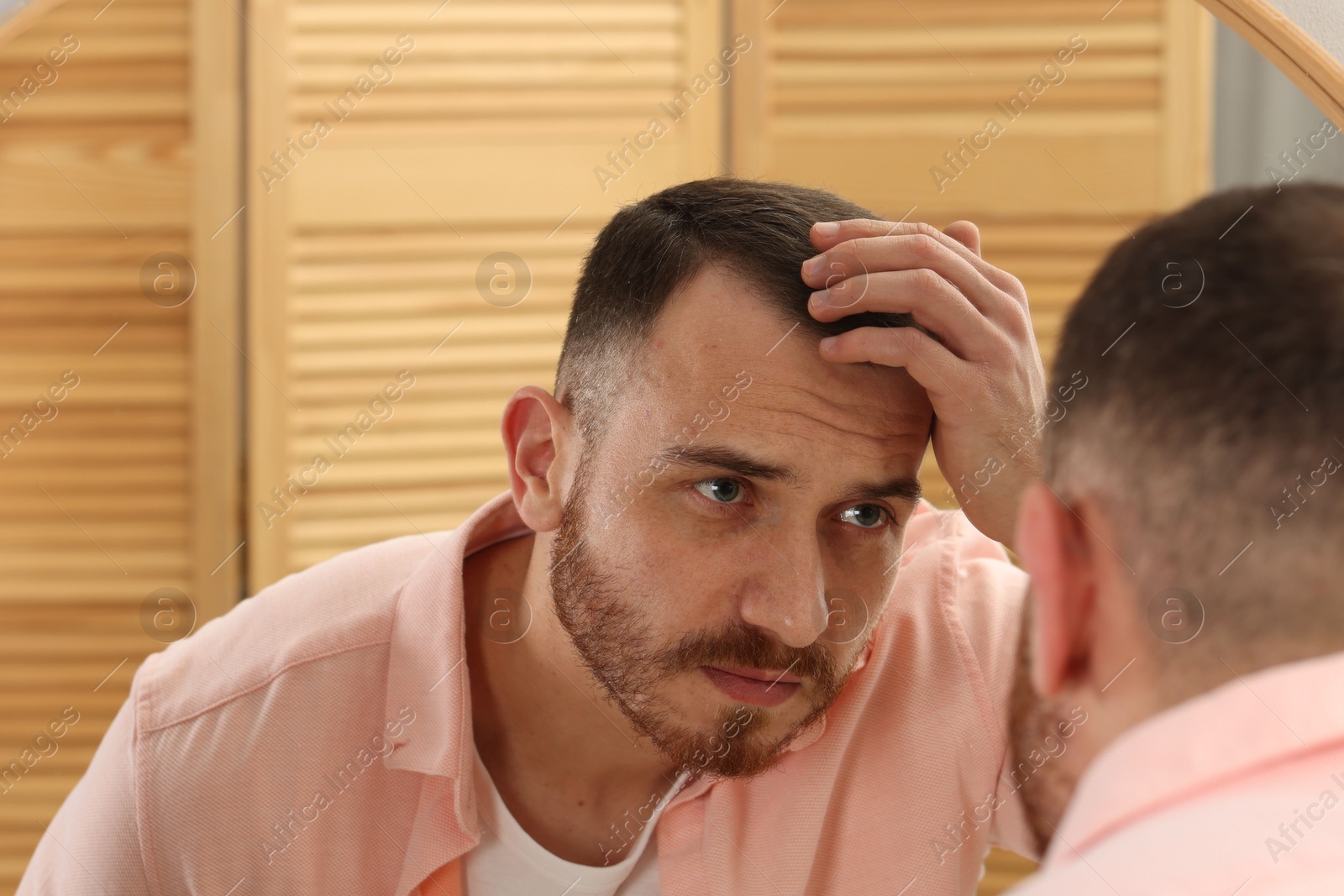 Photo of Baldness problem. Man with receding hairline near mirror at home