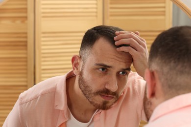 Photo of Baldness problem. Man with receding hairline near mirror at home