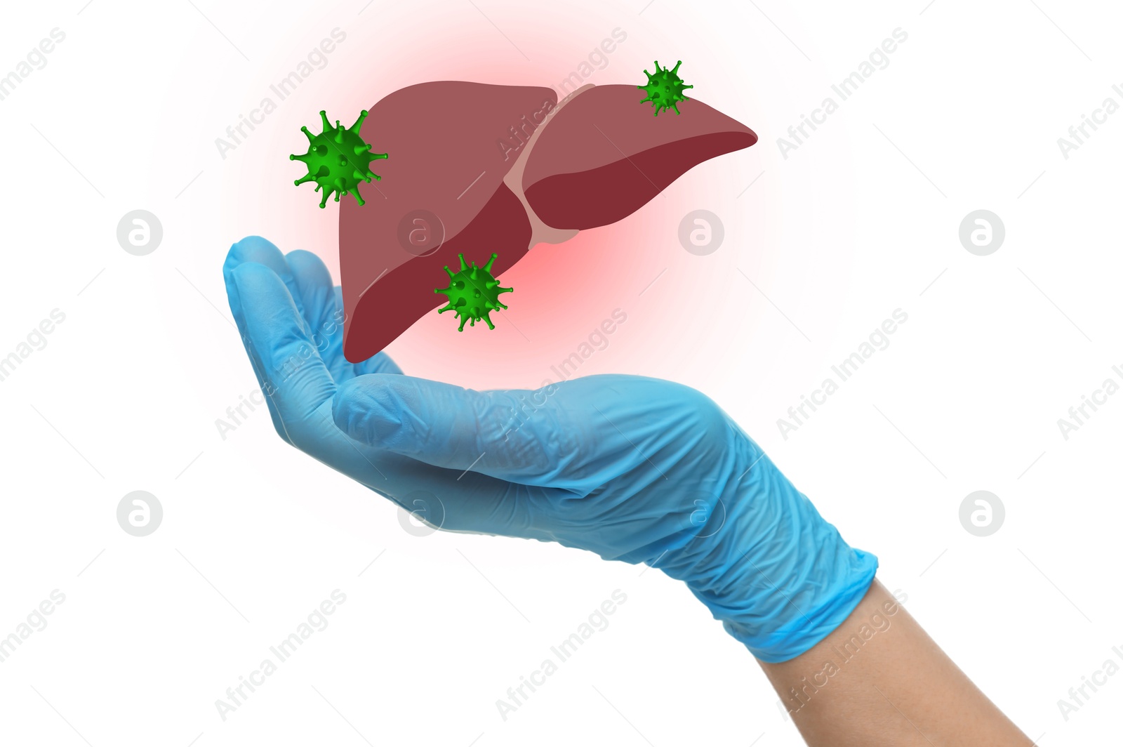 Image of Doctor holding illustration of unhealthy liver on white background, closeup. Hepatitis