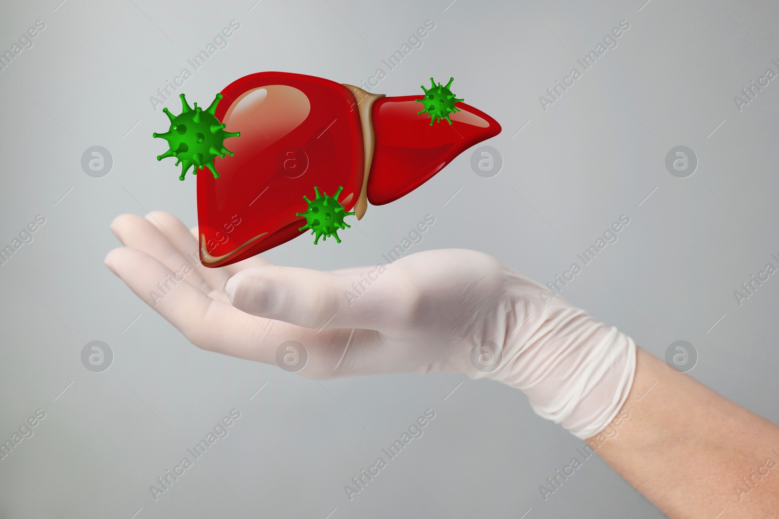 Image of Doctor holding illustration of unhealthy liver on grey background, closeup. Hepatitis