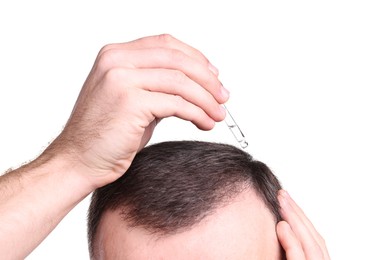 Baldness problem. Man applying serum onto hairline on white background, closeup