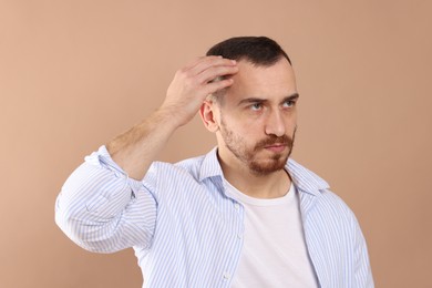 Photo of Baldness problem. Man with receding hairline on beige background