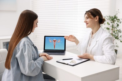 Photo of Contraception. Gynecologist showing image of female reproductive system to woman in clinic