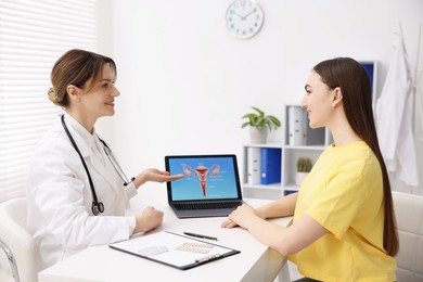 Contraception. Gynecologist showing image of female reproductive system to woman in clinic