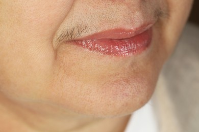 Photo of Hirsutism concept. Senior woman with mustache, closeup