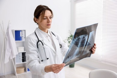 Doctor examining x-ray of lungs in hospital