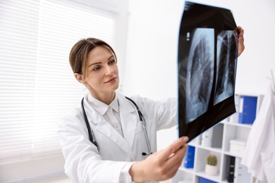 Doctor examining x-ray of lungs in hospital