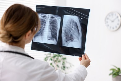 Photo of Doctor examining x-ray of lungs in hospital