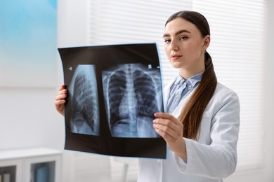 Photo of Doctor examining x-ray of lungs in hospital