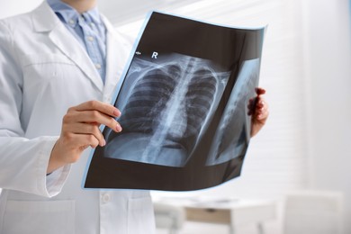 Photo of Doctor examining lungs x-ray in hospital, closeup