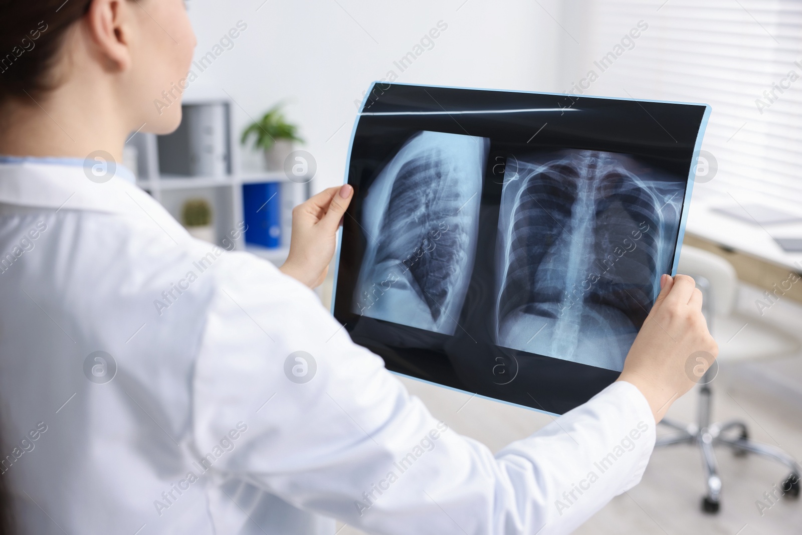 Photo of Doctor examining lungs x-ray in hospital, closeup