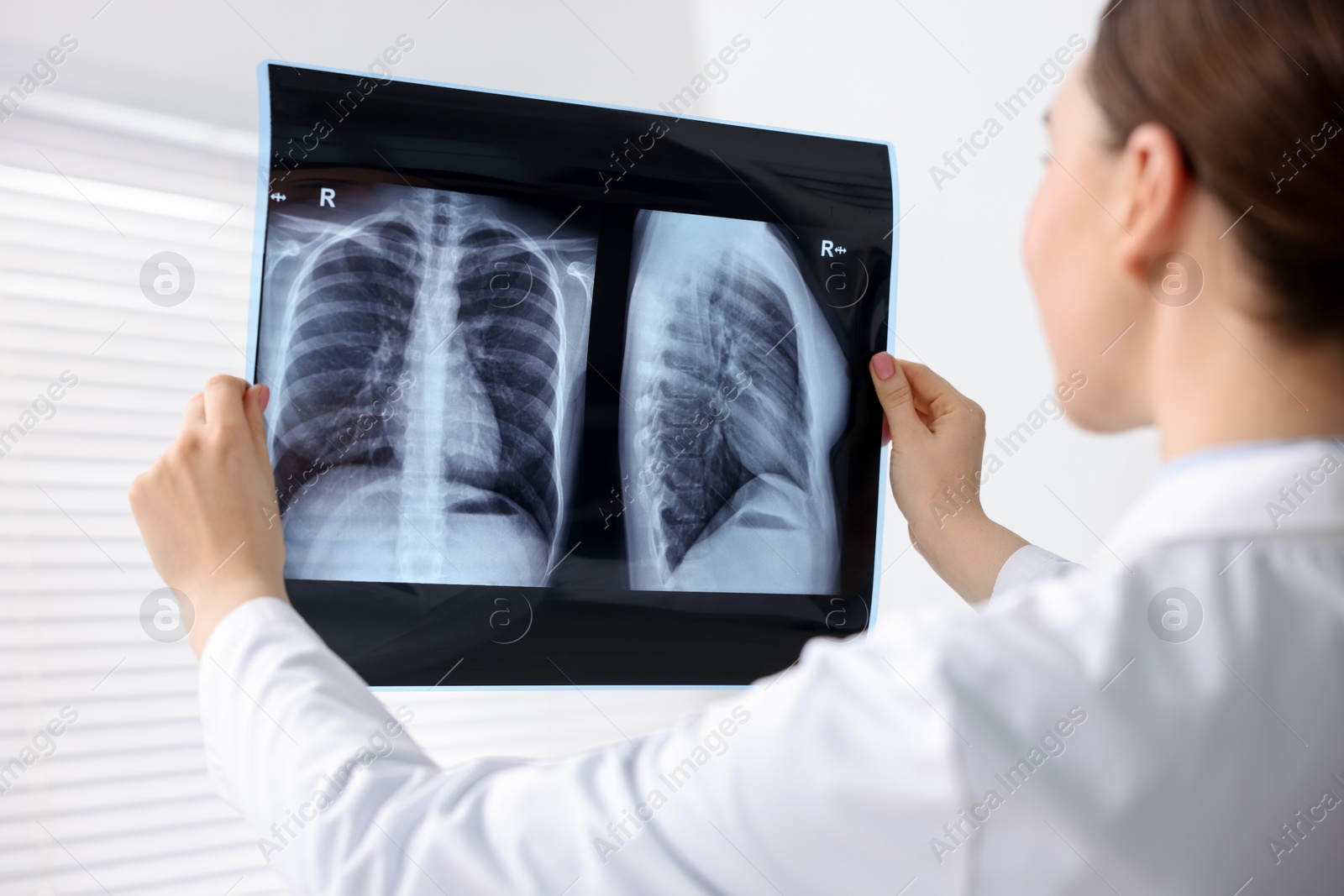 Photo of Doctor examining lungs x-ray in hospital, closeup