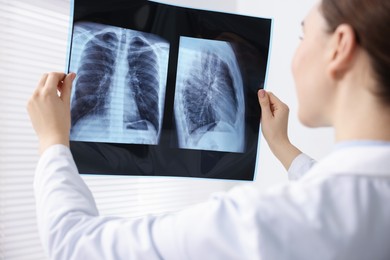 Photo of Doctor examining lungs x-ray in hospital, closeup