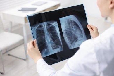 Photo of Doctor examining lungs x-ray in hospital, closeup