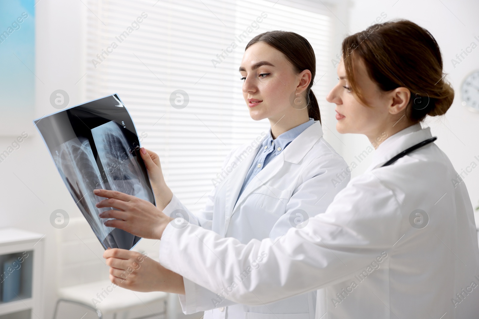 Photo of Doctors examining x-ray of lungs in hospital