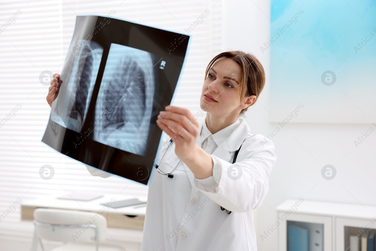 Photo of Doctor examining x-ray of lungs in hospital