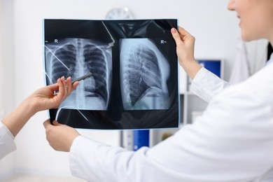 Photo of Doctors examining lungs x-ray in hospital, closeup