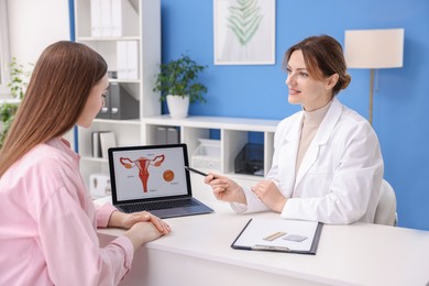 Photo of Contraception. Gynecologist showing image of female reproductive system to woman in clinic