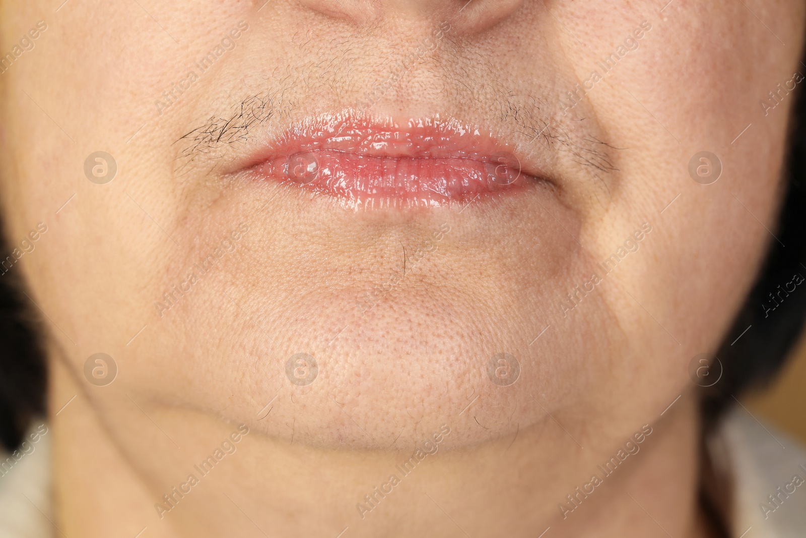 Photo of Hirsutism concept. Senior woman with mustache, closeup