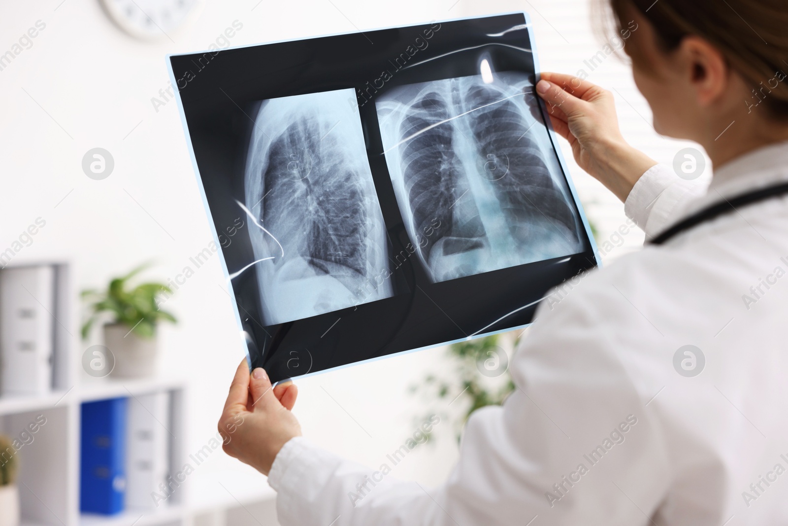 Photo of Doctor examining lungs x-ray in hospital, closeup