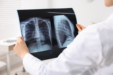 Photo of Doctor examining lungs x-ray in hospital, closeup