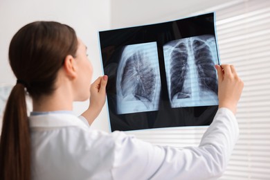 Photo of Doctor examining x-ray of lungs in hospital