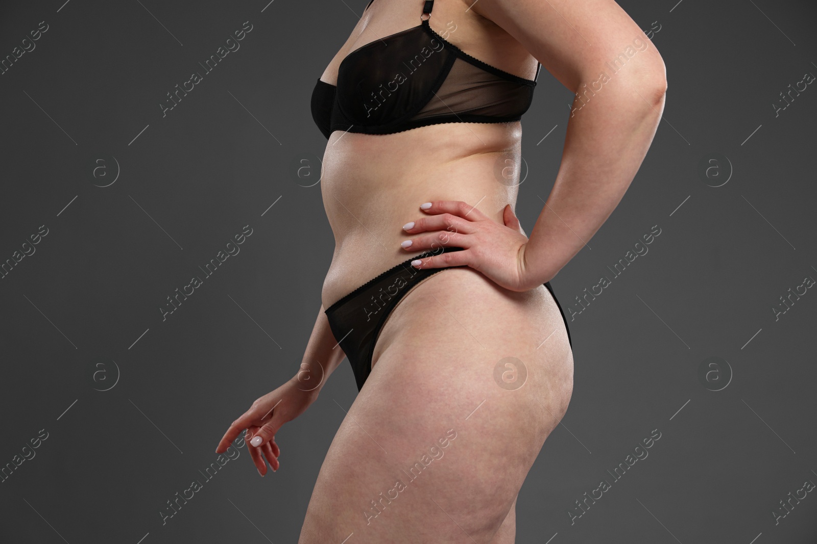 Photo of Woman with cellulite problem on dark grey background, closeup