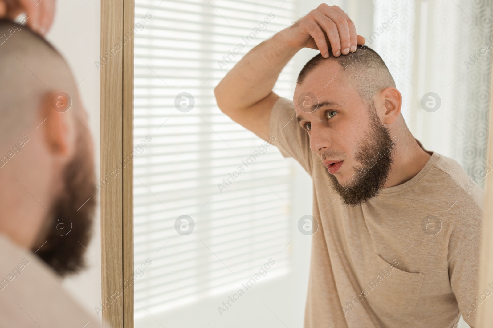 Baldness problem. Man with receding hairline near mirror at home Photo of Baldness problem. Man with receding hairline near mirror at home