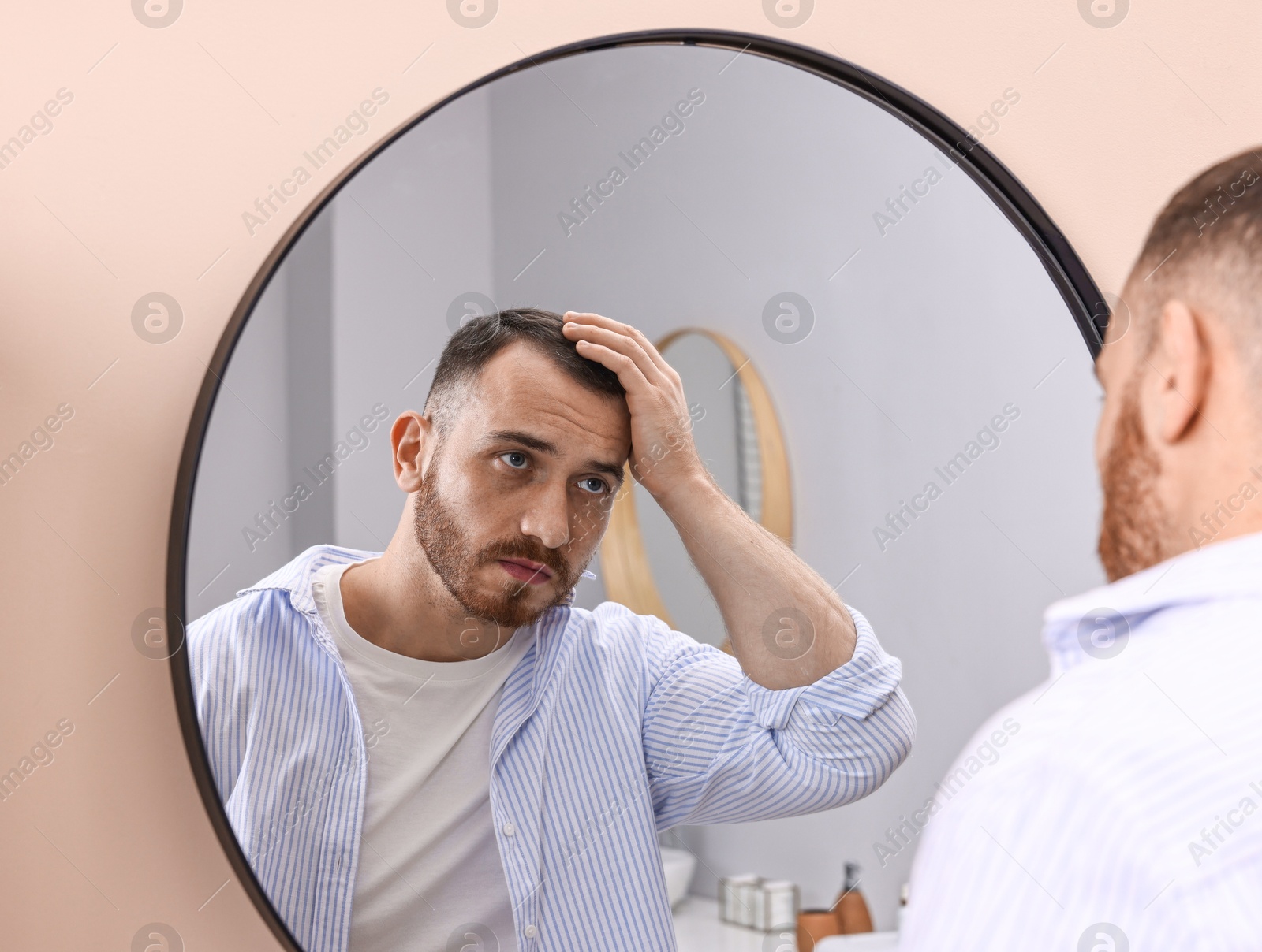 Photo of Baldness problem. Man with receding hairline near mirror in bathroom