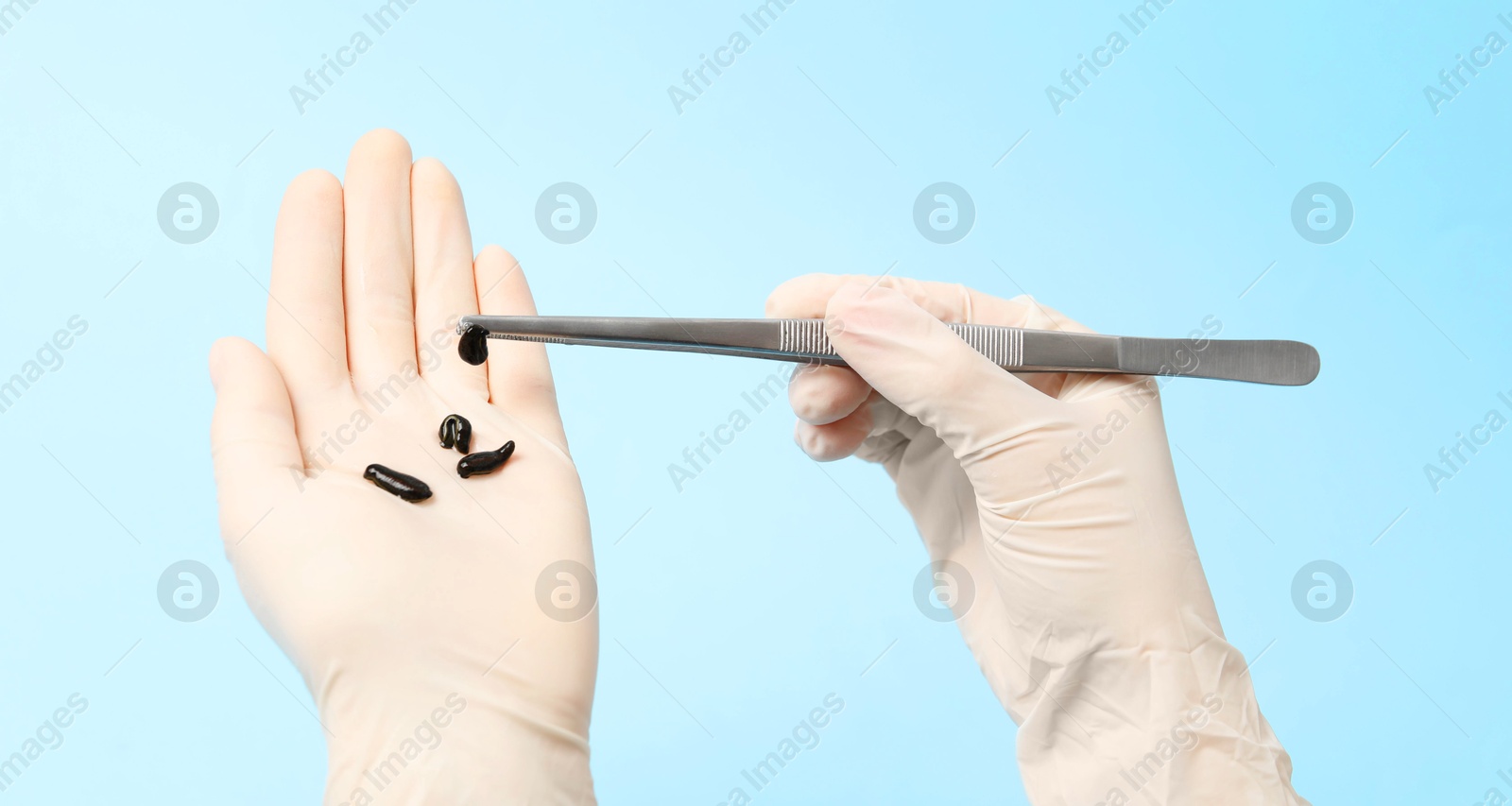 Photo of Woman holding medicinal leech with tweezers on light blue background, closeup