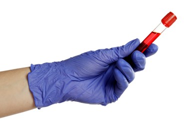 Photo of Doctor in medical glove holding test tube with blood sample on white background, closeup