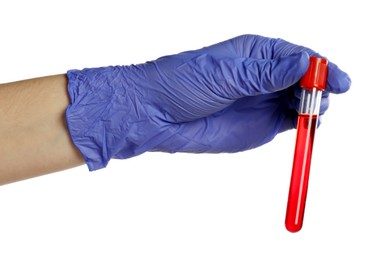 Photo of Doctor in medical glove holding test tube with blood sample on white background, closeup