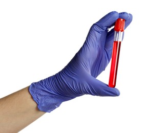 Photo of Doctor in medical glove holding test tube with blood sample on white background, closeup