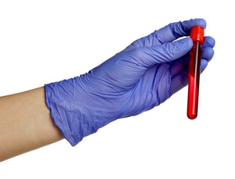 Photo of Doctor in medical glove holding test tube with blood sample on white background, closeup