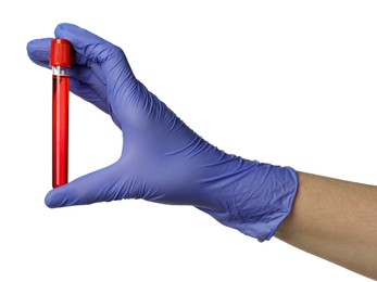 Photo of Doctor in medical glove holding test tube with blood sample on white background, closeup